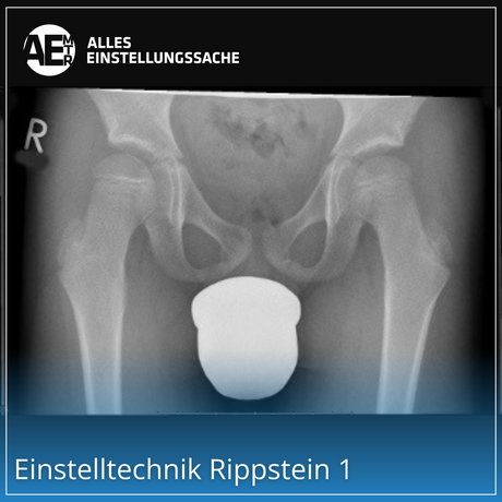 Einstelltechnik Rippstein 1: Optimale Röntgenaufnahme der Hüfte