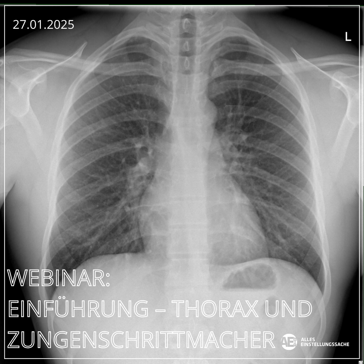 Onlinekurs: Thorax und Zungenschrittmacher I 27.01.2025