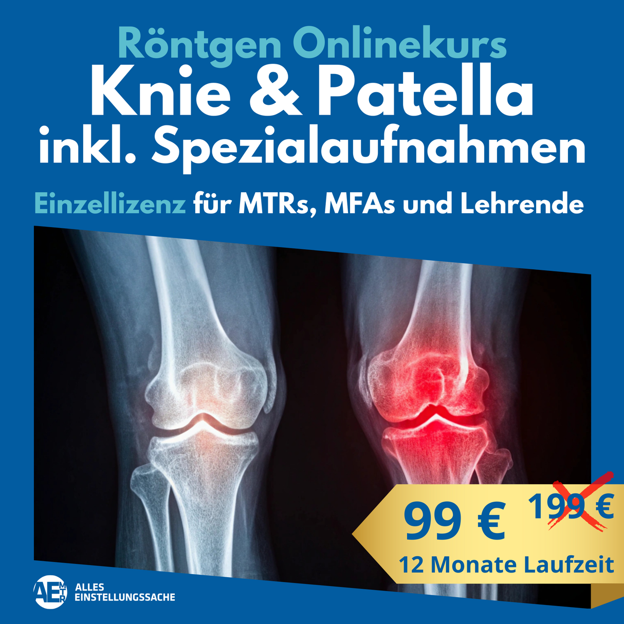 Knie in 2 Ebenen & Patella inkl. Spezialaufnahmen
